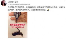 网友爆料耳蜗钉视频,揭秘医疗科技新进展